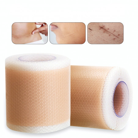 Silicone band scar reduction