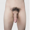 Emisil - 01 Erect - 15 cm - Johnson